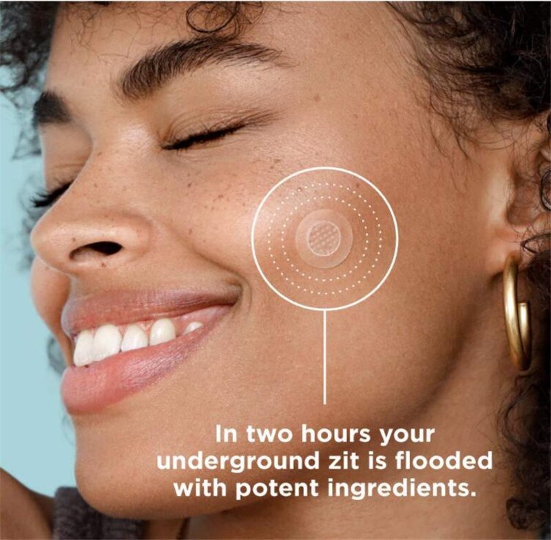 Microneedle Acne Pimple Patches - 9-Pack Fast Healing Zit Stickers with Hyaluronic Acid & Tea Tree Oil