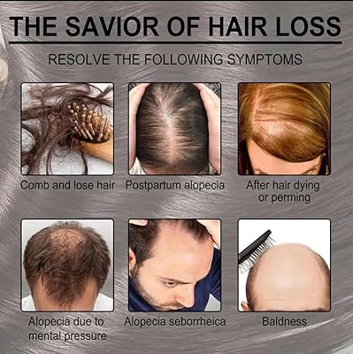 Zarusky Rosemary Hair Dense Essential Oil - Prevent Hair Loss & Strengthen Roots