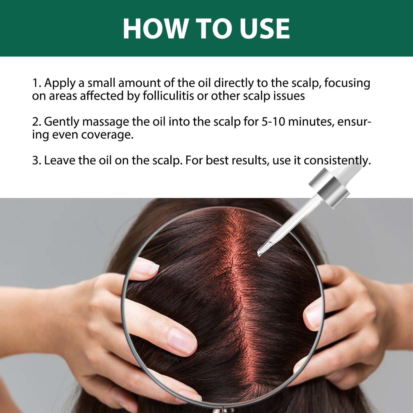 Scalp Treatment Serum - Ginger & Castor Oil Deep Cleansing Essence for Dandruff Repair & Hair Smoothing