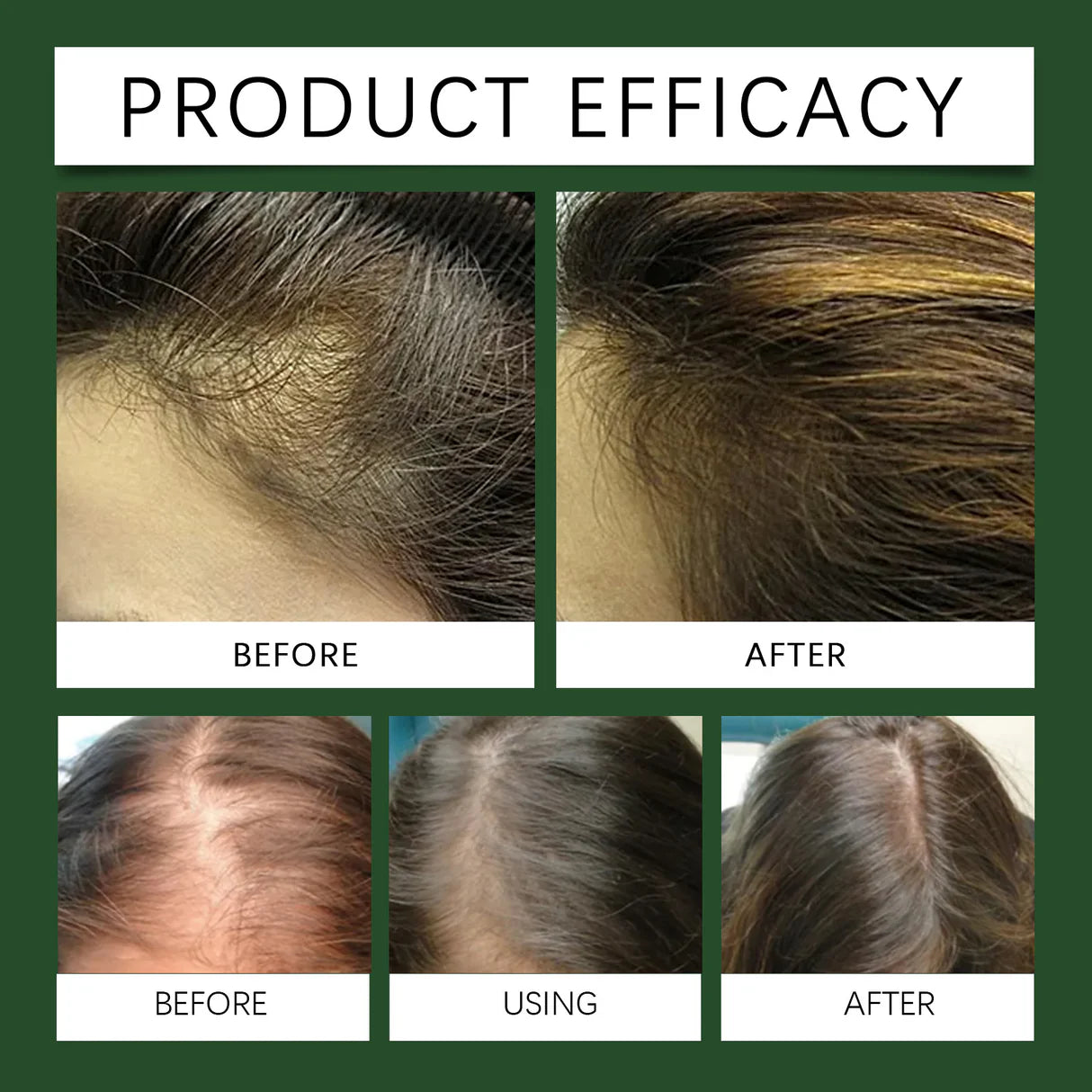 Zarusky Rosemary Oil for Hair Growth - Promotes Healthy Nourishing Strong Hair