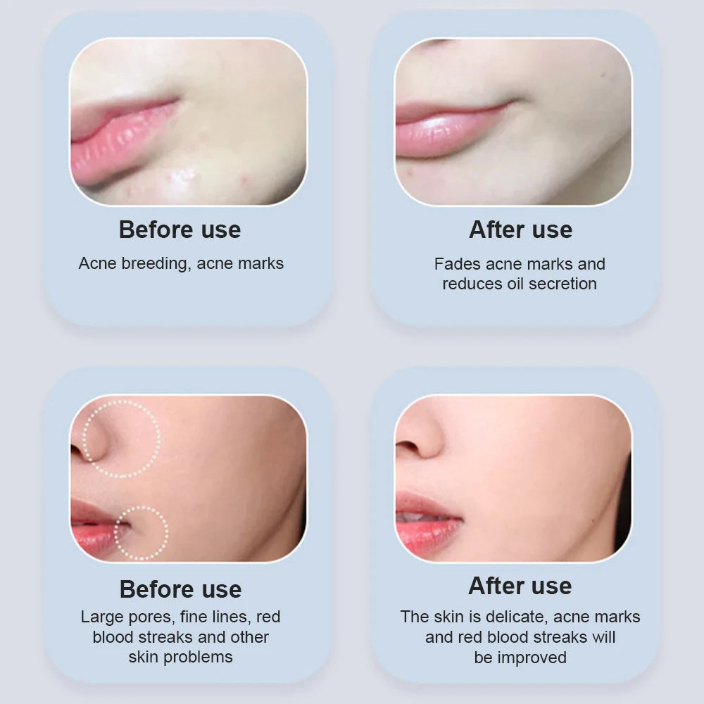 LED Light Therapy Face Mask - 7 Color Photon Skin Rejuvenation Anti-Wrinkle