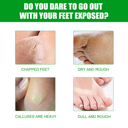 Aloe Vera Foot Mask - Moisturizing Anti-Cracking Dead Skin Removal