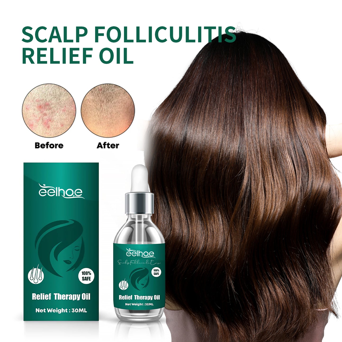 Scalp Treatment Serum - Ginger & Castor Oil Deep Cleansing Essence for Dandruff Repair & Hair Smoothing