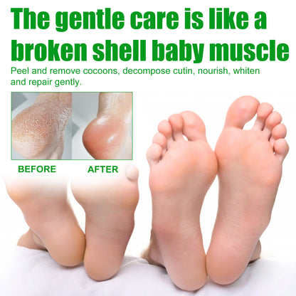 Aloe Vera Foot Mask - Moisturizing Anti-Cracking Dead Skin Removal