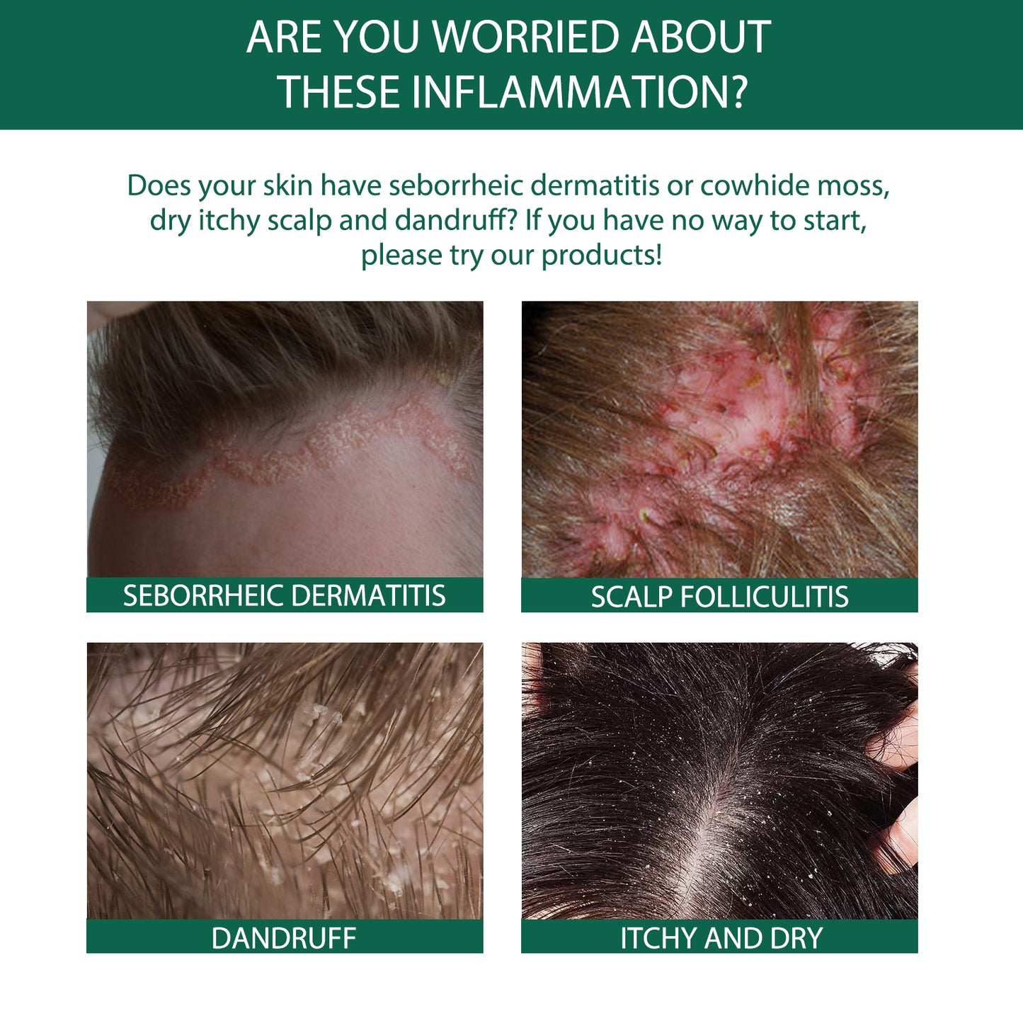 Scalp Treatment Serum - Ginger & Castor Oil Deep Cleansing Essence for Dandruff Repair & Hair Smoothing
