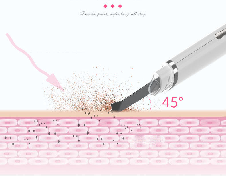 Ultrasonic Facial Peeling Machine – Deep Pore Cleansing, Blackhead & Acne Removal Skin Spatula