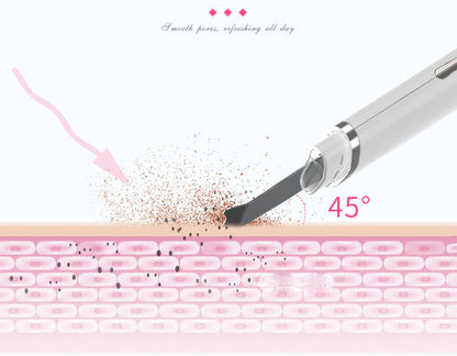 Ultrasonic Facial Peeling Machine – Deep Pore Cleansing, Blackhead & Acne Removal Skin Spatula
