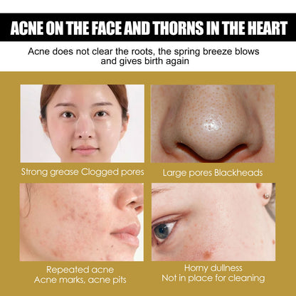 Zarusky Advanced Snail 92 All In One Cream - Brightening Firming Moisturizer