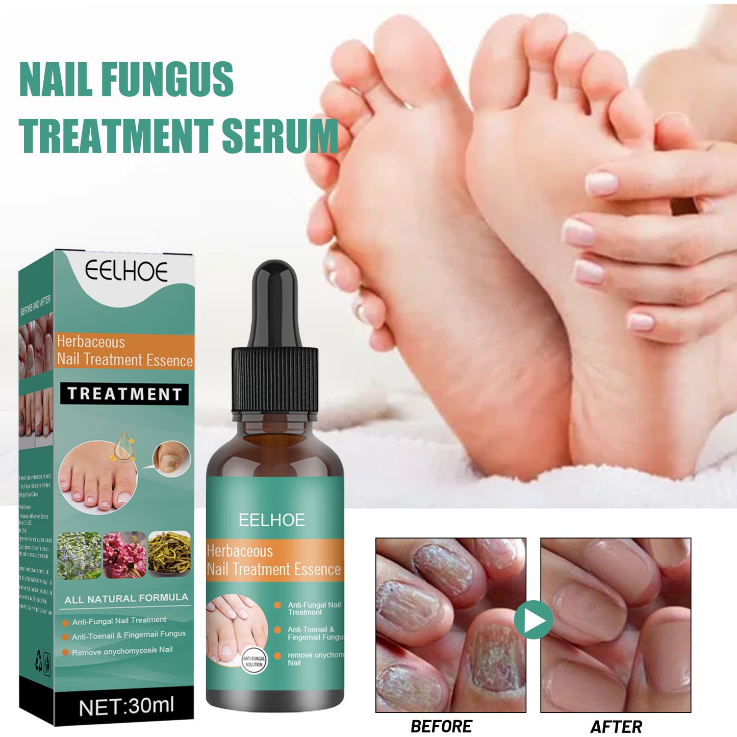 EELHOE Herbaceous Nail Relief Essence – Hand & Foot Care Solution for Softening, Thick Nail Care, Brightening & Bumpy Nails
