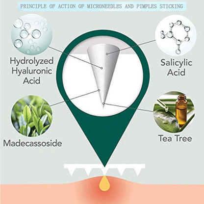 Microneedle Acne Pimple Patches - 9-Pack Fast Healing Zit Stickers with Hyaluronic Acid & Tea Tree Oil