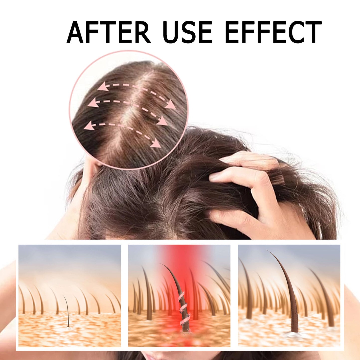 Sérum Capillaire Boost - Prévient la Chute de Cheveux Renforce, Épaissit & Nourrit les Racines