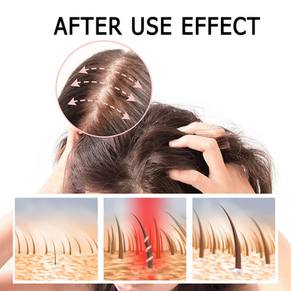 Sérum Capillaire Boost - Prévient la Chute de Cheveux Renforce, Épaissit & Nourrit les Racines