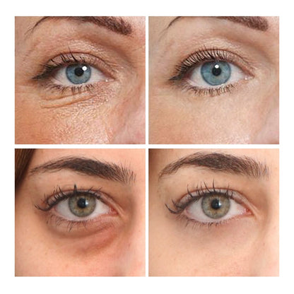 Zarusky™ 24K Gold & Caviar Luxury Eye Lift – 10-Pair Collagen Essence Anti-Aging Patches