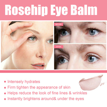 Women Extra Renewing Rosehip Eye Balm Stick – Deep Hydration & Lifting Moisturizer for Delicate Eye Care
