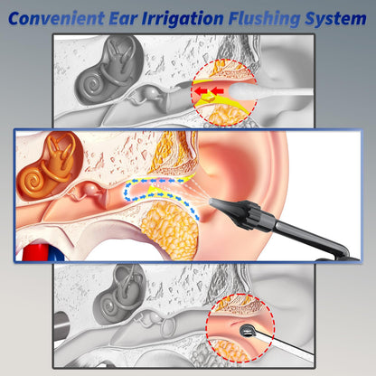 Easy-to-use electric ear washer for gentle household ear cleaning. Designed for convenient earwax rinsing with controlled water flow.