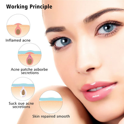 Acne Pimple Patches - 36-Pack Invisible Hydrocolloid Stickers for Spot Treatment & Scar Care