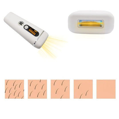 IPL Laser Hair Removal Device - Portable Painless At-Home Treatment
