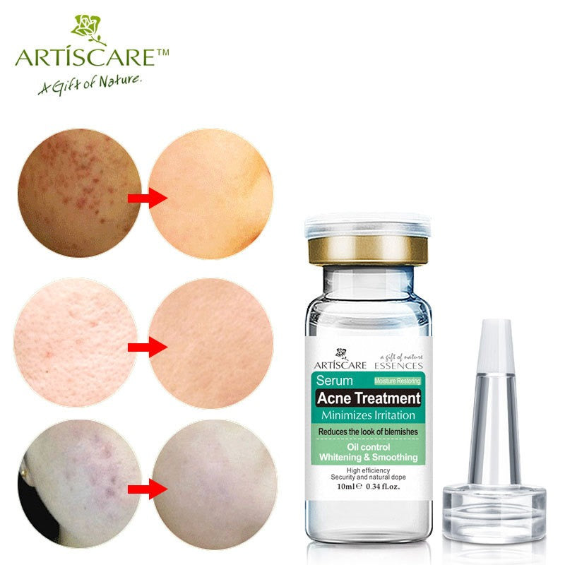 ARTISARE Acne Original Liquid Essence - Tea Tree Essence 10ml