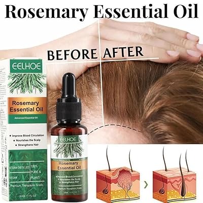 Zarusky Rosemary Hair Dense Essential Oil - Prevent Hair Loss & Strengthen Roots