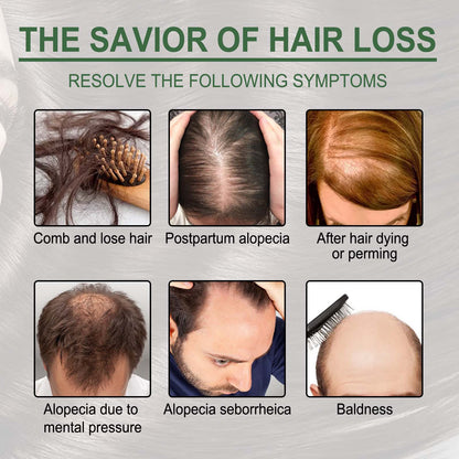 Zarusky Rosemary Oil Capsules – Strengthen Hair Roots & Stop Hair Loss | USA 2-6 Days