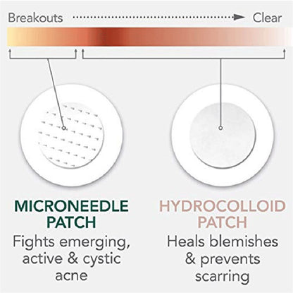 Microneedle Acne Pimple Patches - 9-Pack Fast Healing Zit Stickers with Hyaluronic Acid & Tea Tree Oil