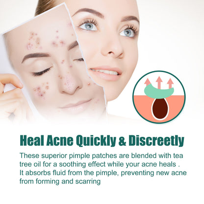 EELHOE Colorful Acne Patch – Cute Shaped Blemish Patches for Repair, Clean Care & Spot Coverage