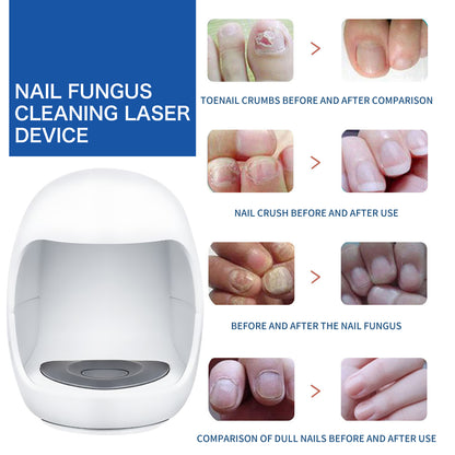 South Moon Nail Care Phototherapy Device – Hands & Feet Repair Tool for Gray, Yellow, Soft & Ingrown Nails