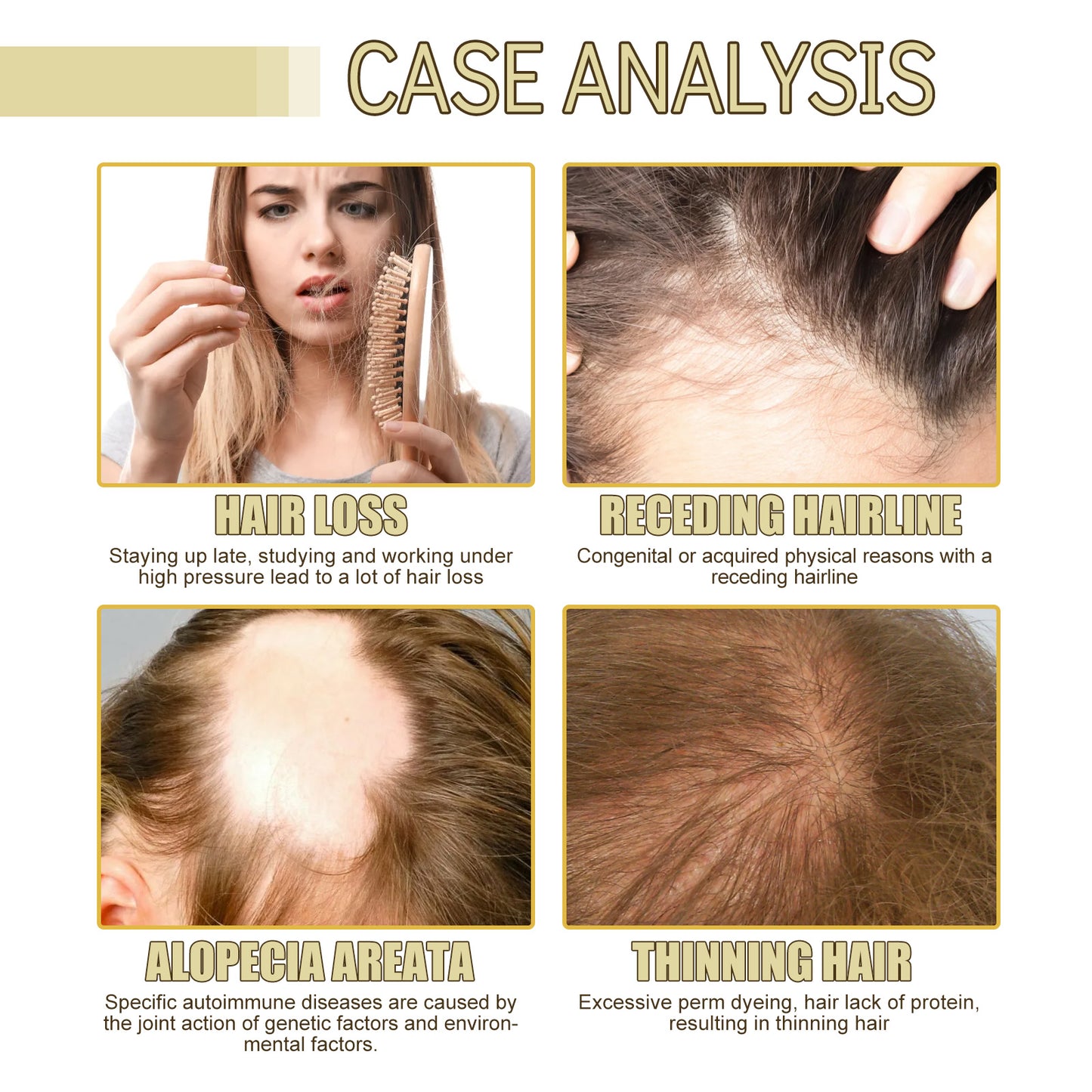 Zarusky Rosemary & Argan Hair Growth Oil – Nourishing Scalp Treatment | USA 2-6 Days