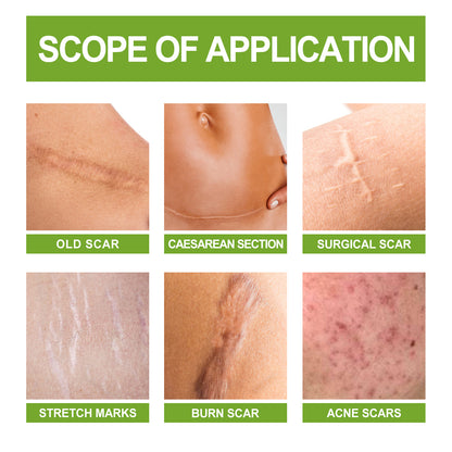 Zarusky Scar Repair Serum - Reduces Acne Marks, Pregnancy & Surgery Scars
