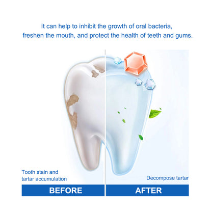 "Teeth Whitening Serum - Remove Plaque, Stains & Bad Breath | Zarusky"