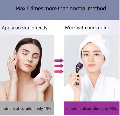 540 Microneedle Derma Roller – Titanium Skin Renewal Tool for Acne Scars, Absorption & Skin Texture