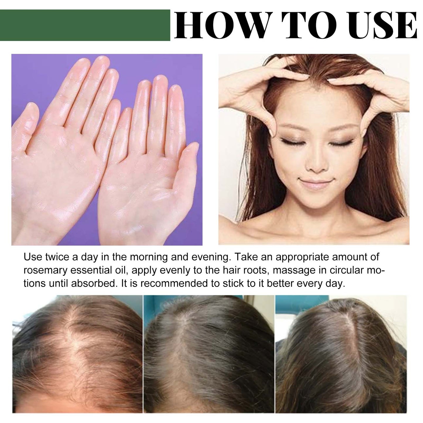 Zarusky Rosemary Oil Capsules – Strengthen Hair Roots & Stop Hair Loss | USA 2-6 Days