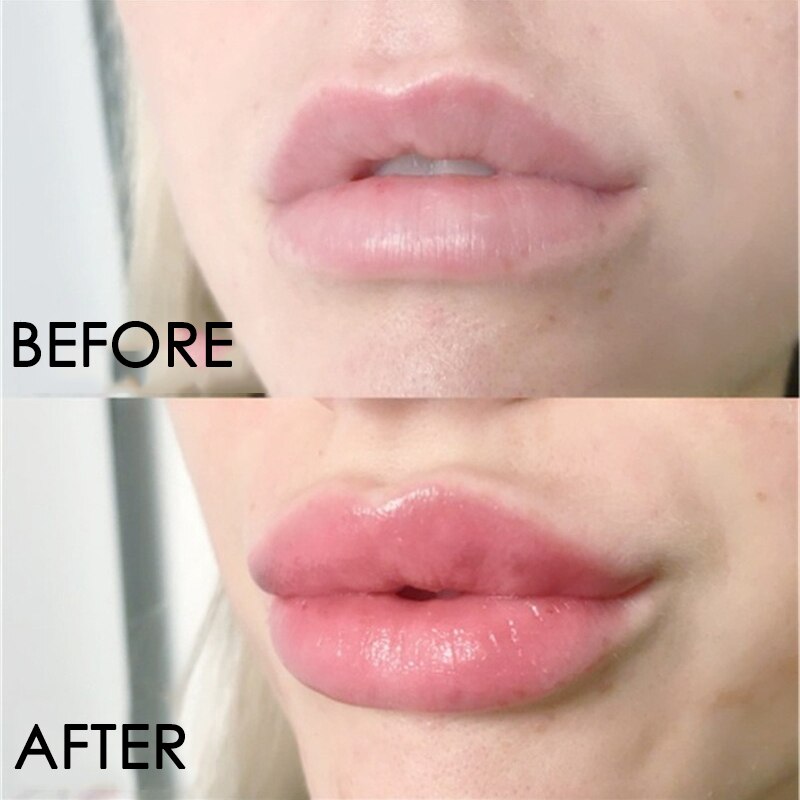 Zarusky™ Lip-Inject Volume Serum – Instant Collagen Plumper & Repairing Gloss