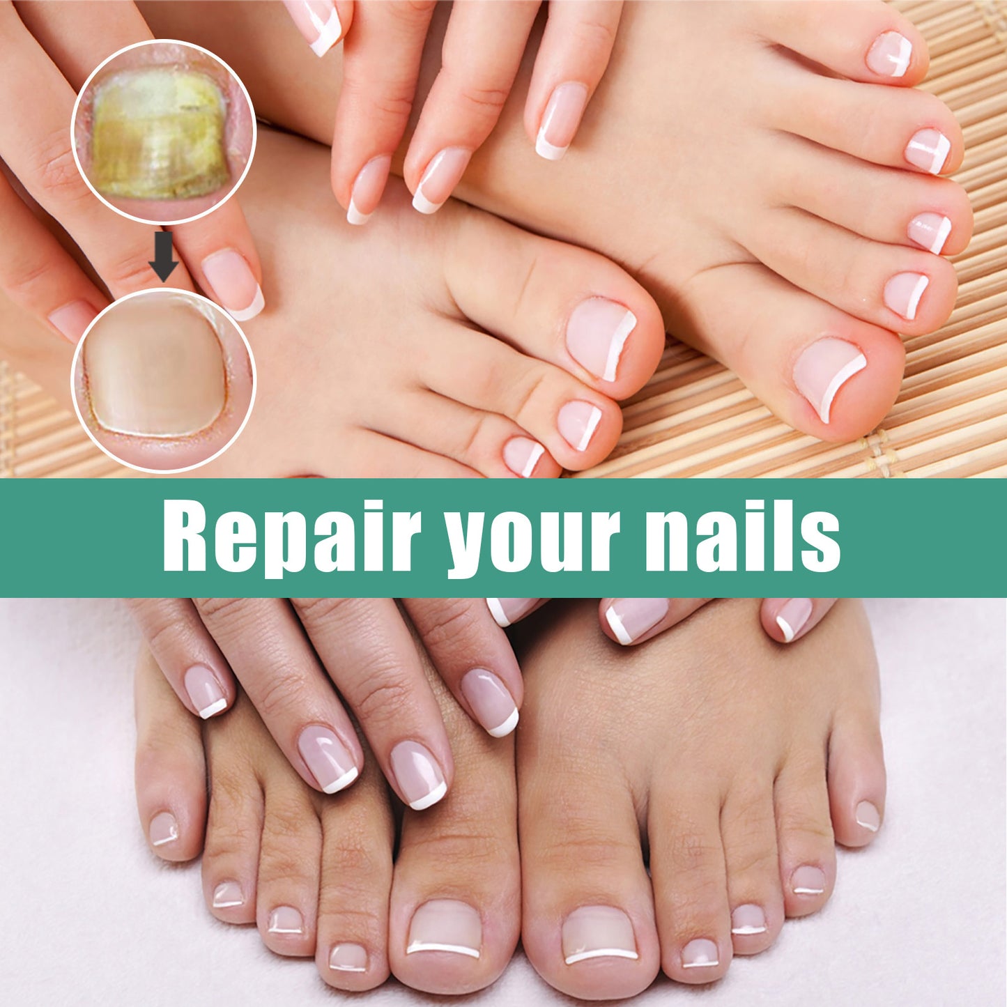 EELHOE Herbaceous Nail Relief Essence – Hand & Foot Care Solution for Softening, Thick Nail Care, Brightening & Bumpy Nails