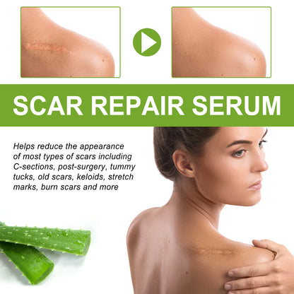 Zarusky Scar Repair Serum - Reduces Acne Marks, Pregnancy & Surgery Scars