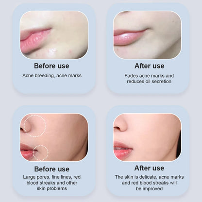 LED Light Therapy Face Mask - 7 Color Photon Skin Rejuvenation Anti-Wrinkle