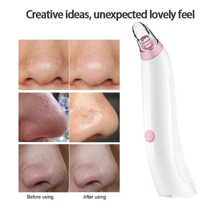 Zarusky Face Blackhead Pore Cleaner - Vacuum Blackhead Remover Tool