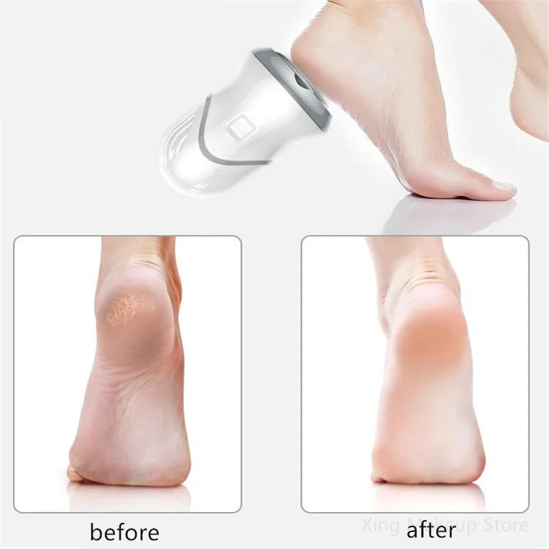 USB Rechargeable Electric Foot Massager for Pain Relief, Deep Kneading & Relaxation – Portable Home Spa Device