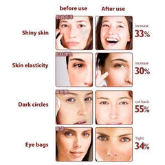 Zarusky Pen Type Eye Massager - Electric Vibration Stick for Eye Bags & Face Lifting